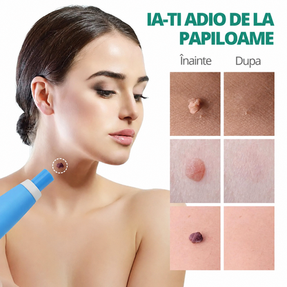 Kit Eliminator de Papiloame şi Imperfecțiuni ale pielii