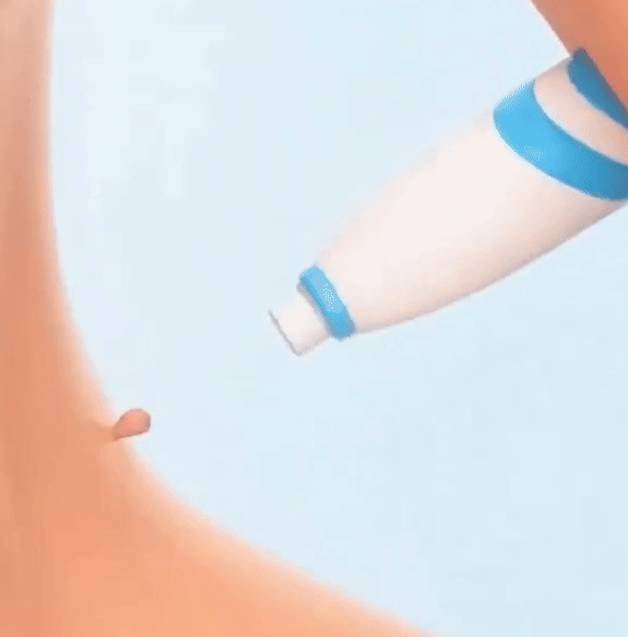 Kit Eliminator de Papiloame şi Imperfecțiuni ale pielii